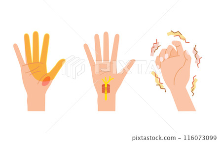 Menopausal disorder in women: Carpal tunnel syndrome image illustration set Menopausal disorder in women: Carpal tunnel syndrome image illustration set 116073099