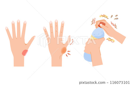 女性更年期：拇指 CM 關節病圖像插圖集 116073101