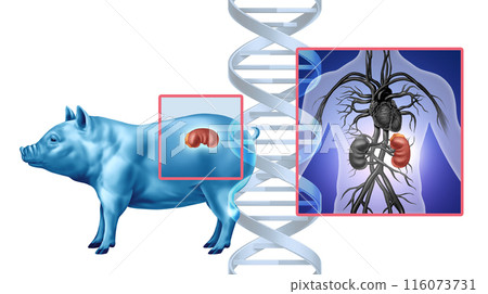 Pig Kidney Transplant Pig Kidney Transplant 116073731