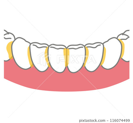 牙齒、牙膏、剩菜之間積聚的牙菌斑 牙齒、牙膏、剩菜之間積聚的牙菌斑 116074499