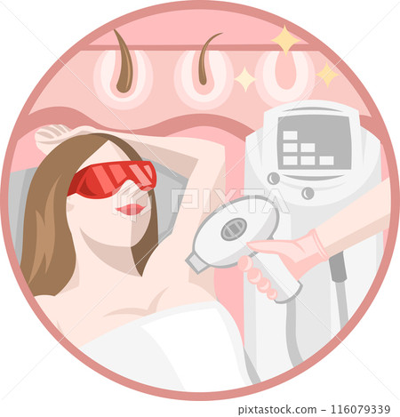 Cosmetologist removes unwanted hair from underarm area body of a girl with a help of laser epilation procedure 116079339