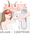 Cosmetologist removes unwanted hair from underarm area body of a girl with a help of laser epilation procedure 116079340