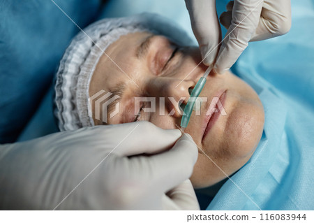 Top view closeup of surgeon adjusting oxygen tube for patient lying on operating table copy space 116083944