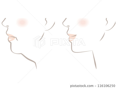 下巴下垂 116106250