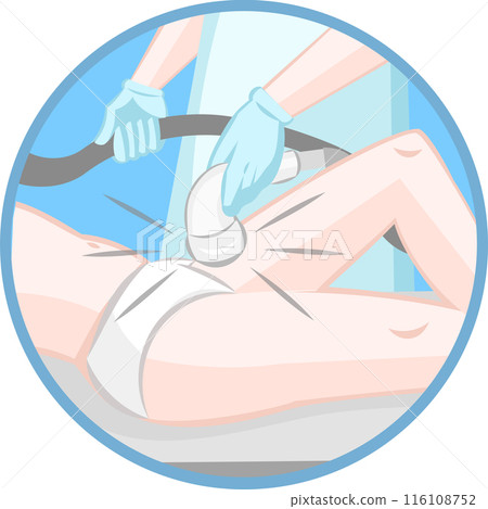 Cosmetologist removes unwanted hair from bikini area body of a girl with a help of laser epilation procedure Cosmetologist removes unwanted hair from bikini area body of a girl with a help of laser epilation procedure 116108752