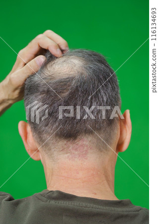 A man with thinning hair is standing with his back to the viewer, set against a green background 116134693