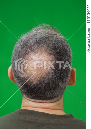 A man with thinning hair is standing with his back to the viewer, set against a green background A man with thinning hair is standing with his back to the viewer, set against a green background 116134695
