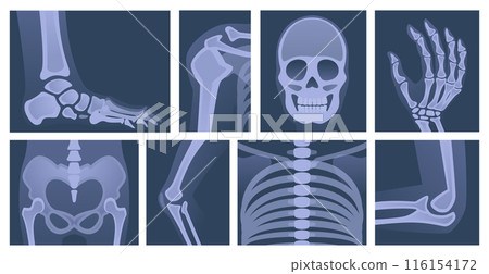 Human skeleton. X ray body parts skull bones of arms knee and legs exact vector medical picture scanning 116154172