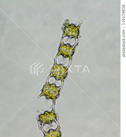 Diatom: Diatom rendella 116159656