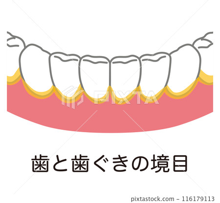 牙菌斑積聚在牙齒和牙齦之間的邊界處，是刷牙時殘留的 116179113