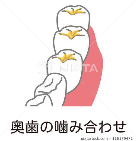 Plaque accumulated on the bite of the back teeth, brushing, and areas left unbrushed 116179471