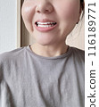 牙齒美白 116189771