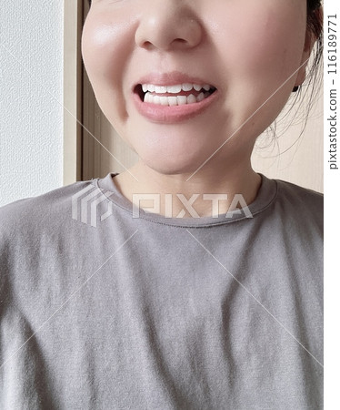 Teeth whitening 116189771