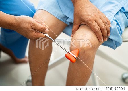 Doctor neurologist testing reflex knee with hammer and show Asian senior scars surgical total knee joint replacement. Doctor neurologist testing reflex knee with hammer and show Asian senior scars surgical total knee joint replacement. 116190604