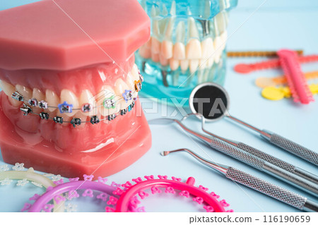 Orthodontic ligatures rings and ties, elastic rubber bands on orthodontic braces, model for dentist studying about dentistry. Orthodontic ligatures rings and ties, elastic rubber bands on orthodontic braces, model for dentist studying about dentistry. 116190659