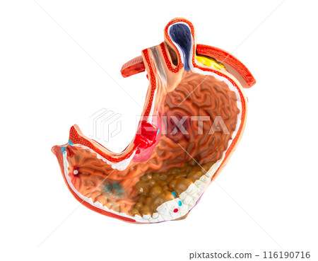 Intestine, appendix and digestive system, anatomy model for study diagnosis and treatment in hospital. Intestine, appendix and digestive system, anatomy model for study diagnosis and treatment in hospital. 116190716