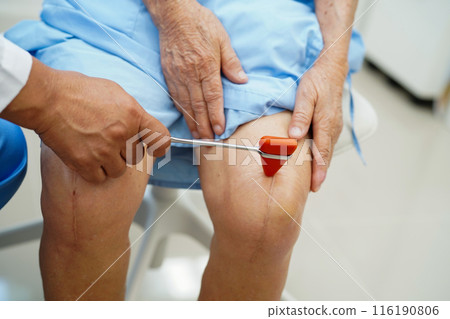 Doctor neurologist testing reflex knee with hammer and show Asian senior scars surgical total knee joint replacement. 116190806