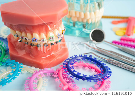 Orthodontic ligatures rings and ties, elastic rubber bands on orthodontic braces, model for dentist studying about dentistry. 116191010