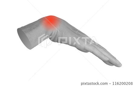 Wrist ache, pain, hand joint injury, inflammation isolated on white background 116200208