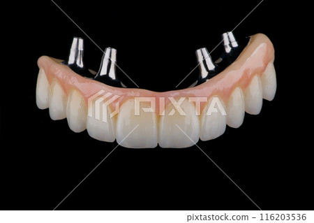 Two stages of making full dental zirkonium prosthesis on titanium bar. Raw before sintering and layered or painted zirkonium. Two stages of making full dental zirkonium prosthesis on titanium bar. Raw before sintering and layered or painted zirkonium. 116203536