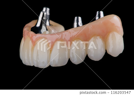 Two stages of making full dental zirkonium prosthesis on titanium bar. Raw before sintering and layered or painted zirkonium. Two stages of making full dental zirkonium prosthesis on titanium bar. Raw before sintering and layered or painted zirkonium. 116203547