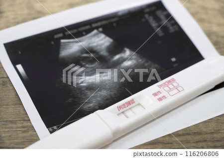 Pregnancy Ultrasound Photo Pregnancy Test 116206806
