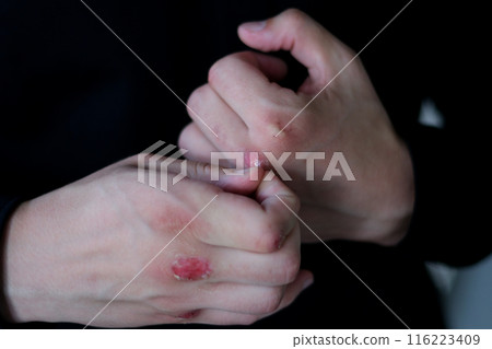 Close up boxing trainer or manager wrapping hands of a boxer reparing for boxing match boxer with broken hands bleeding puts on a black shirt. Handsome man with black hair and blue eyes. Mixed race 116223409