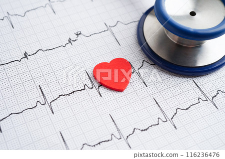 Stethoscope on electrocardiogram (ECG), heart wave, heart attack, cardiogram report. Stethoscope on electrocardiogram (ECG), heart wave, heart attack, cardiogram report. 116236476