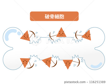 Mechanism of bone resorption by osteoclasts. Bone remodeling Mechanism of bone resorption by osteoclasts. Bone remodeling 116251389