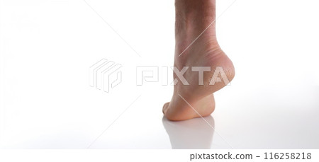 Heel of foot with bad skin, covered with cracks, use medical treatment, moisturizing cream or peeling 116258218