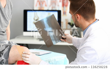 Physician doctor examining patient leg, hold x ray of bone, injury after accident 116258228