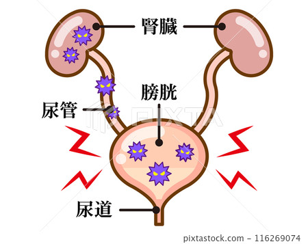 膀胱炎簡單插畫素材 116269074