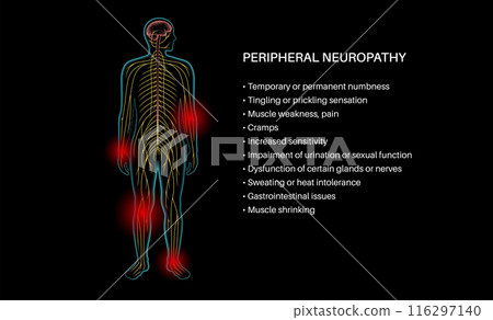 Peripheral neuropathy medical poster 116297140