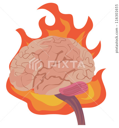 大腦著火的插圖 116301655
