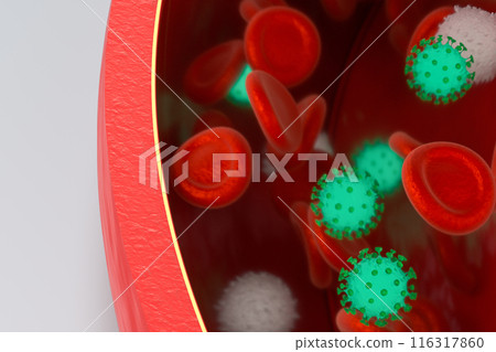 Virus in the blood vessel, with Red and white Virus in the blood vessel, with Red and white 116317860