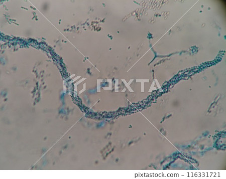 A close-up look at tangled mold hyphae 116331721