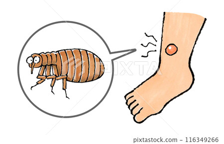 Flea-bitten feet (blisters) Flea-bitten feet (blisters) 116349266