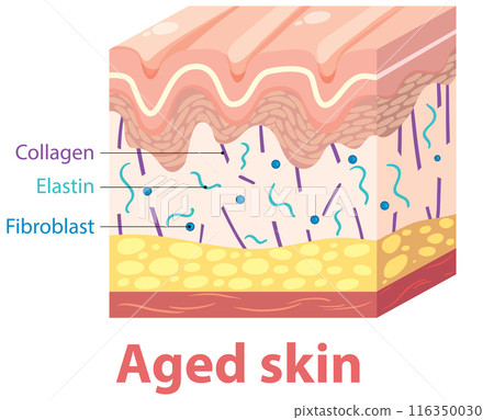 Aged Skin Cross-Section Diagram Aged Skin Cross-Section Diagram 116350030