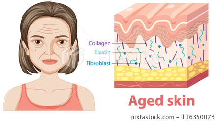 Illustration of Aged Skin Structure Illustration of Aged Skin Structure 116350073