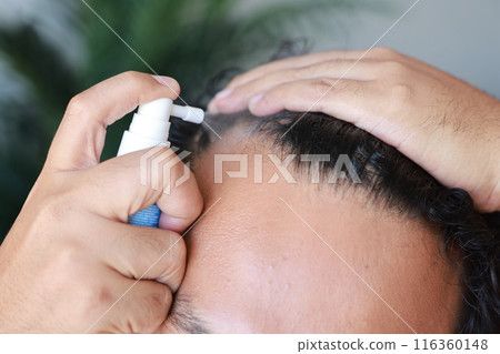 Asian men use serum spray to maintain strong hair and prevent breakage. Man with worry and touching on his head to show a bald head. Hair root nourishment. concept of healthcare, treat, medicine. Asian men use serum spray to maintain strong hair and prevent breakage. Man with worry and touching on his head to show a bald head. Hair root nourishment. concept of healthcare, treat, medicine. 116360148
