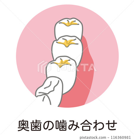 Plaque accumulated on the bite of the back teeth, brushing, and areas left unbrushed 116360981