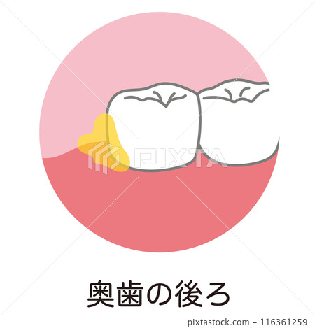 後牙、刷牙、剩菜後堆積的牙菌斑 116361259