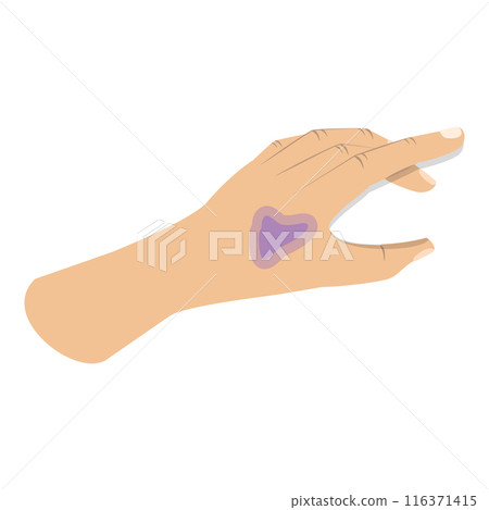3D Isometric Flat  Illustration of First Aid For Trauma. Item 6 116371415