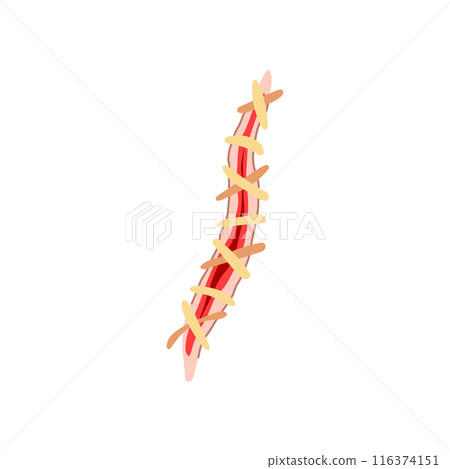 needle suture cartoon vector illustration 116374151