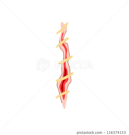 surgery suture cartoon vector illustration surgery suture cartoon vector illustration 116374153