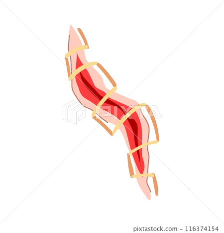 scar suture cartoon vector illustration scar suture cartoon vector illustration 116374154