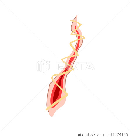 wound suture cartoon vector illustration wound suture cartoon vector illustration 116374155