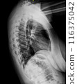 X-ray of thoracic spine. Lateral view. Vertebrae and intervertebral joints of chest. Healthy backbone anatomy radiography image 116375042