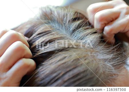 A woman who is worried about the white hair on her hairline 116397308