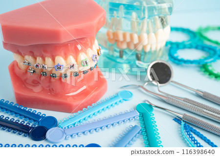 Orthodontic ligatures rings and ties, elastic rubber bands on orthodontic braces, model for dentist studying about dentistry. 116398640